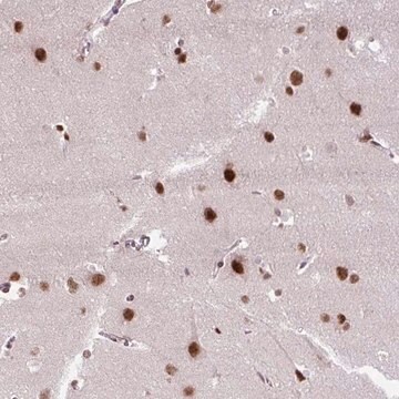 Anti-ZNF672 antibody produced in rabbit Prestige Antibodies&#174; Powered by Atlas Antibodies, affinity isolated antibody, buffered aqueous glycerol solution