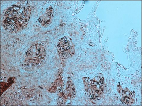 Anti-Endothelial Cells antibody, Mouse monoclonal clone P1H12, purified from hybridoma cell culture