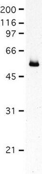 Anti-Fascin Antibody, clone 55K2 clone 55K2, Chemicon&#174;, from mouse