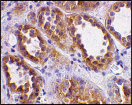 Anti-ACE2 antibody produced in rabbit affinity isolated antibody