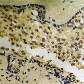 Anti-phospho-Akt (pThr72) antibody produced in rabbit affinity isolated antibody