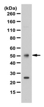 Anti-FOXL2 Antibody from rabbit, purified by affinity chromatography