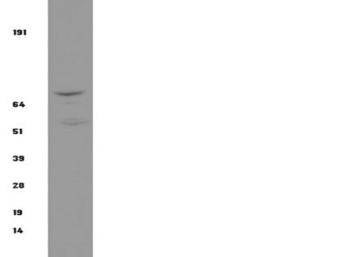 Anti-IKK&#946; Antibody, clone 10AG2 clone 10AG2, Upstate&#174;, from mouse