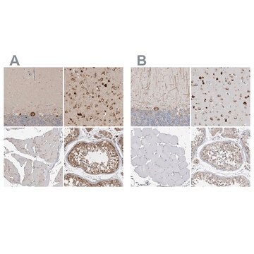 Anti-ATXN2 antibody produced in rabbit affinity isolated antibody, buffered aqueous glycerol solution, Ab3