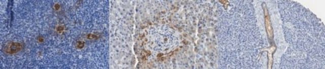 Anti-Peripheral Node Addressin (PNAd) Antibody, clone MECA-79 clone MECA-79, from rat