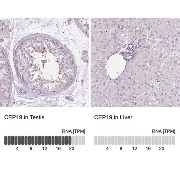 Anti-CEP19 antibody produced in rabbit Prestige Antibodies&#174; Powered by Atlas Antibodies, affinity isolated antibody, buffered aqueous glycerol solution