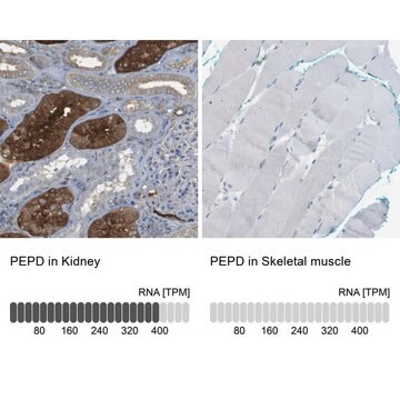 Anti-PEPD antibody produced in rabbit Prestige Antibodies&#174; Powered by Atlas Antibodies, affinity isolated antibody, buffered aqueous glycerol solution