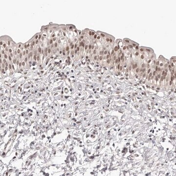 Anti-RNF2 antibody produced in rabbit Prestige Antibodies&#174; Powered by Atlas Antibodies, affinity isolated antibody, buffered aqueous glycerol solution