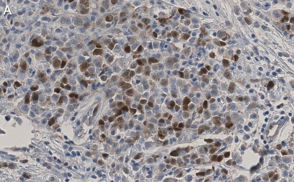 Anti-CDK1/CDC2 Antibody, clone 1J8 ZooMAb&#174; Rabbit Monoclonal recombinant, expressed in HEK 293 cells