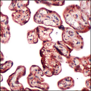 Anti-PI3K P85 antibody, Rabbit monoclonal recombinant, expressed in proprietary host, clone SP62, affinity isolated antibody