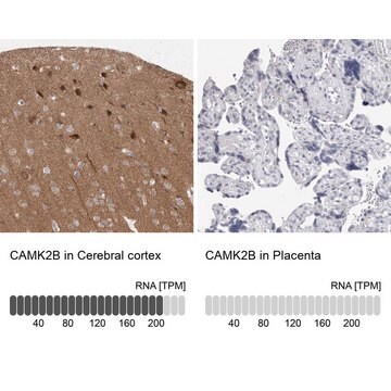 Anti-CAMK2B antibody produced in rabbit Prestige Antibodies&#174; Powered by Atlas Antibodies, affinity isolated antibody, buffered aqueous glycerol solution