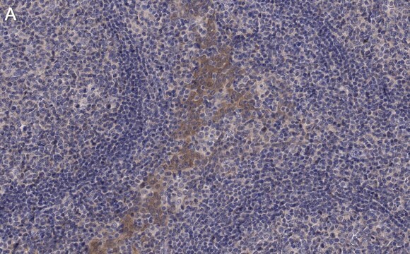 Anti-CCR2 Antibody, clone 5K5-3 ZooMAb&#174; Rabbit Monoclonal recombinant, expressed in HEK 293 cells