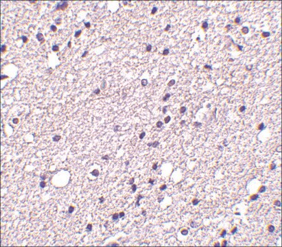 Anti-NK3R antibody produced in rabbit affinity isolated antibody, buffered aqueous solution