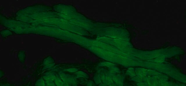 Anti-Myopodin antibody produced in rabbit affinity isolated antibody, buffered aqueous solution