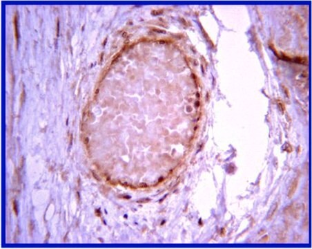 Anti-Calcineurin Antibody from rabbit, purified by affinity chromatography