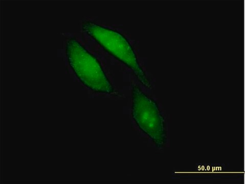 Anti-BRCC3 antibody produced in mouse IgG fraction of antiserum, buffered aqueous solution