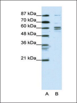 Anti-GTF2F1 antibody produced in rabbit affinity isolated antibody