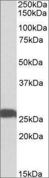 Anti-UCHL1 antibody produced in goat affinity isolated antibody, buffered aqueous solution