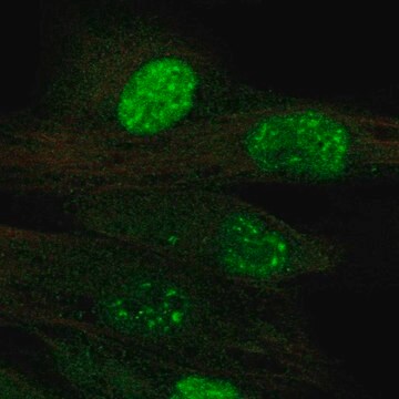 Anti-TERT antibody produced in rabbit Prestige Antibodies&#174; Powered by Atlas Antibodies, affinity isolated antibody