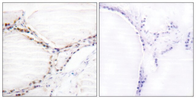 Anti-Vitamin D Receptor antibody produced in rabbit affinity isolated antibody