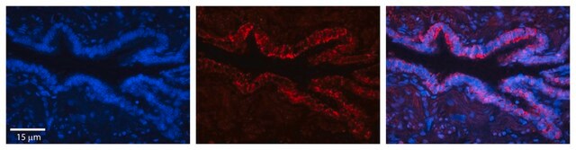 Anti-SLC16A1 antibody produced in rabbit affinity isolated antibody