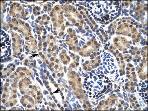 Anti-PHKG2 antibody produced in rabbit affinity isolated antibody