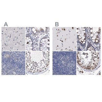 Anti-GOLGA2 antibody produced in rabbit Prestige Antibodies&#174; Powered by Atlas Antibodies, affinity isolated antibody, buffered aqueous glycerol solution, Ab1