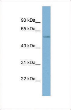 Anti-MARVELD2 antibody produced in rabbit affinity isolated antibody