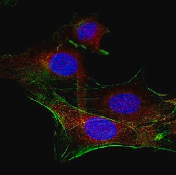 Anti-PDGFR Beta Antibody from rabbit, purified by affinity chromatography