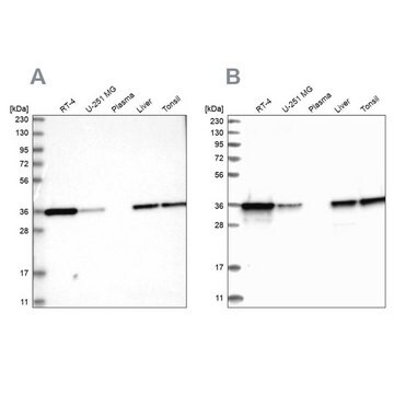 Anti-PDXK antibody produced in rabbit Prestige Antibodies&#174; Powered by Atlas Antibodies, affinity isolated antibody, buffered aqueous glycerol solution, ab2