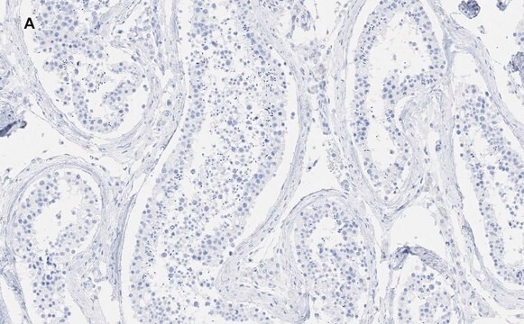 Anti-GAPDH Antibody, clone 10B13, ZooMAb&#174; Rabbit Monoclonal recombinant, expressed in HEK 293 cells