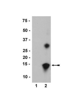 Anti-nitro-&#945;/&#946;-Synuclein (Tyr39) Antibody, clone nSyn14 clone nSyn14, Upstate&#174;, from mouse