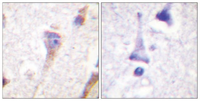 Anti-PKD1 antibody produced in rabbit affinity isolated antibody