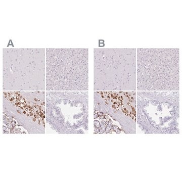 Anti-PAPPA2 antibody produced in rabbit Prestige Antibodies&#174; Powered by Atlas Antibodies, affinity isolated antibody, buffered aqueous glycerol solution