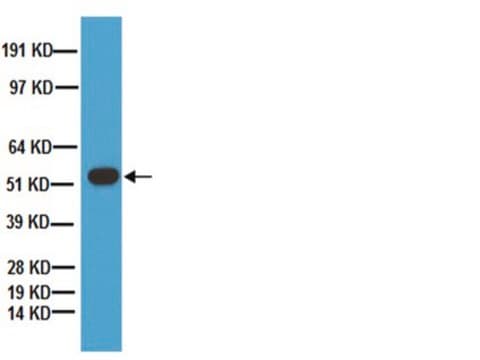 Anti-Tryptophan Hydroxylase Antibody Chemicon&#174;, from sheep