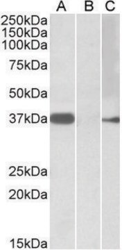 Anti-MYF6 antibody produced in goat affinity isolated antibody, buffered aqueous solution