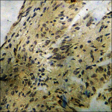 Anti-phospho-BCL-2 (pSer70) antibody produced in rabbit affinity isolated antibody