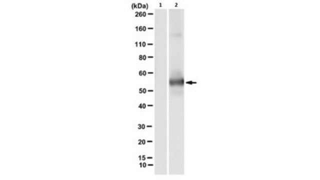 Anti-phospho-cytokeratin-8 (K8) (Ser73) Antibody, clone LJ4 clone LJ4, from mouse