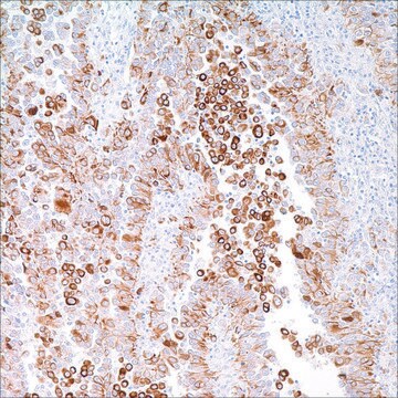 Cytokeratin 5 &amp; 6 (D5 &amp; 16B4) Mouse Monoclonal Antibody