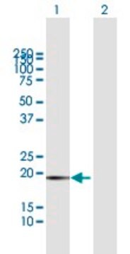 Anti-FTL antibody produced in mouse purified immunoglobulin, buffered aqueous solution