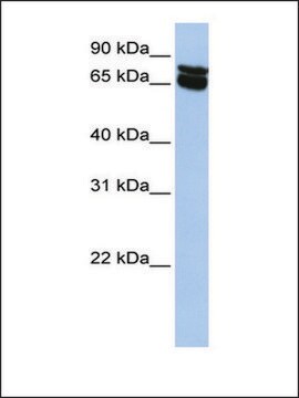 Anti-B4GALNT1 antibody produced in rabbit affinity isolated antibody