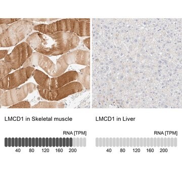 Anti-LMCD1 antibody produced in rabbit Prestige Antibodies&#174; Powered by Atlas Antibodies, affinity isolated antibody, buffered aqueous glycerol solution