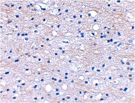 抗BRAL1抗体 from rabbit, purified by affinity chromatography