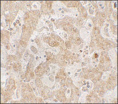 Anti-CCR7 antibody produced in rabbit affinity isolated antibody