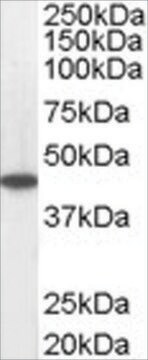 Anti-ACADM antibody produced in goat affinity isolated antibody, buffered aqueous solution