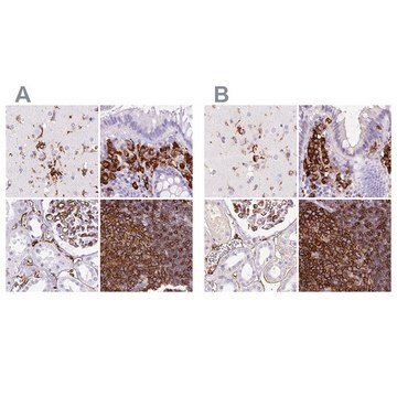 Anti-HLA-DRA antibody produced in rabbit Prestige Antibodies&#174; Powered by Atlas Antibodies, affinity isolated antibody, buffered aqueous glycerol solution