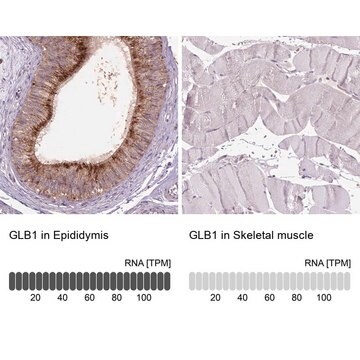 Anti-GLB1 antibody produced in rabbit Prestige Antibodies&#174; Powered by Atlas Antibodies, affinity isolated antibody, buffered aqueous glycerol solution