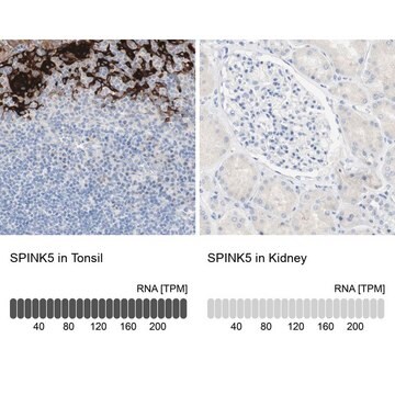 Anti-SPINK5 antibody produced in rabbit Prestige Antibodies&#174; Powered by Atlas Antibodies, affinity isolated antibody, buffered aqueous glycerol solution