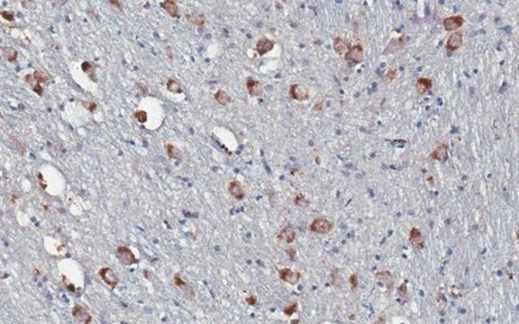 Anti-Prodynorphin (Dynorphin B29) Antibody, clone Dyn9 clone Dyn9, from mouse