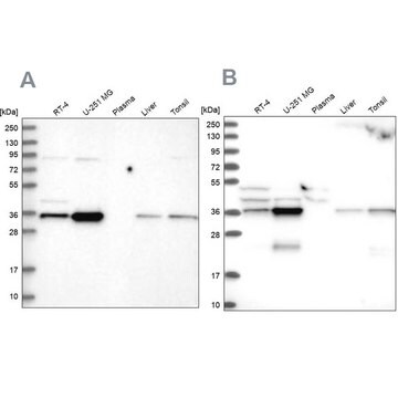 Anti-GPATCH11 antibody produced in rabbit Prestige Antibodies&#174; Powered by Atlas Antibodies, affinity isolated antibody, buffered aqueous glycerol solution